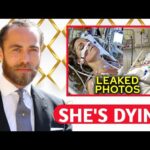 James Middleton Expose Catherine's True State Of Health, She's Dying