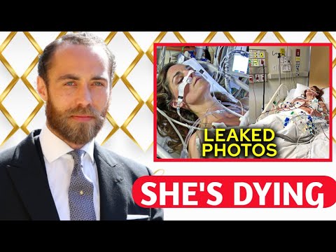 James Middleton Expose Catherine's True State Of Health, She's Dying