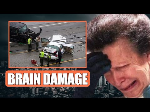 BRAIN DAMAGE!⛔ Princess Anne Suffers BRAIN DAMAGE After Being Involved In Fatal Car ACCID£NT