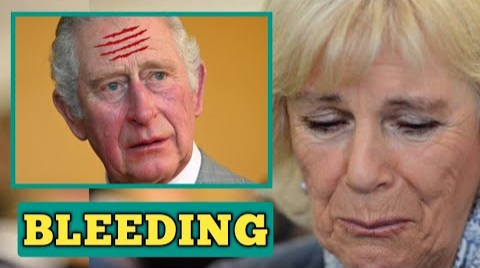 BLEEDING! Queen Camilla Sad As Protesters ATTACK And Beat Up King Charles III Leaving Him UNCONSCIOUS And Wounded